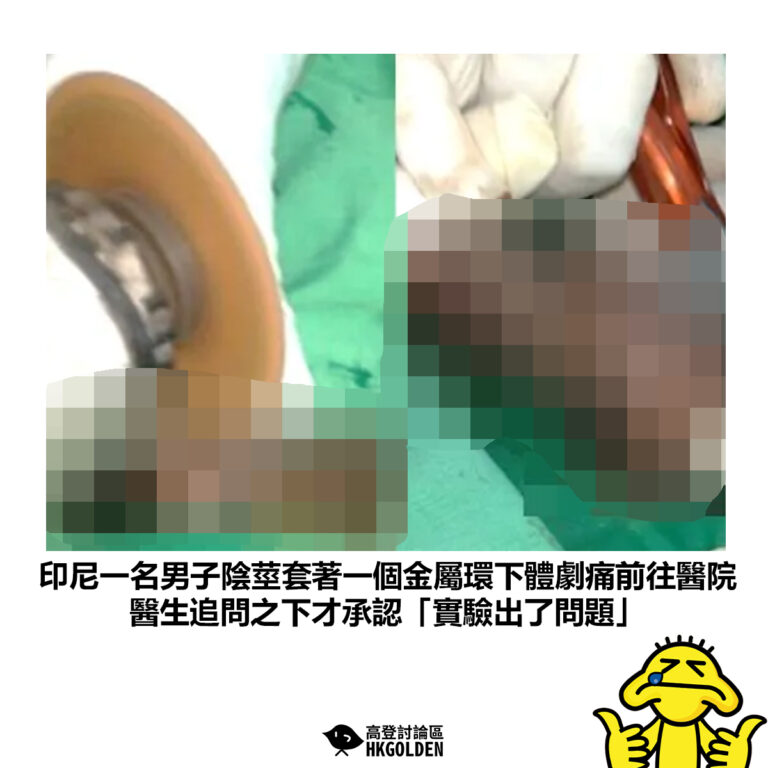 【印尼一名男子陰莖套著一個金屬環下體劇痛前往醫院 醫生追問之下才承認「實驗出了問題」】