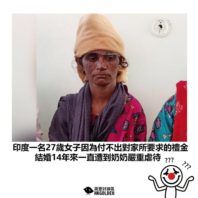 【印度一名27歲女子因為付不出對家所要求的禮金 結婚14年來一直遭到奶奶嚴重虐待 】