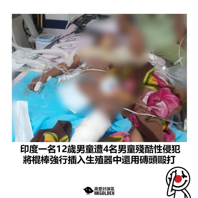 【印度一名12歲男童遭4名男童殘酷性侵犯 將棍棒強行插入生殖器中還用磚頭毆打】