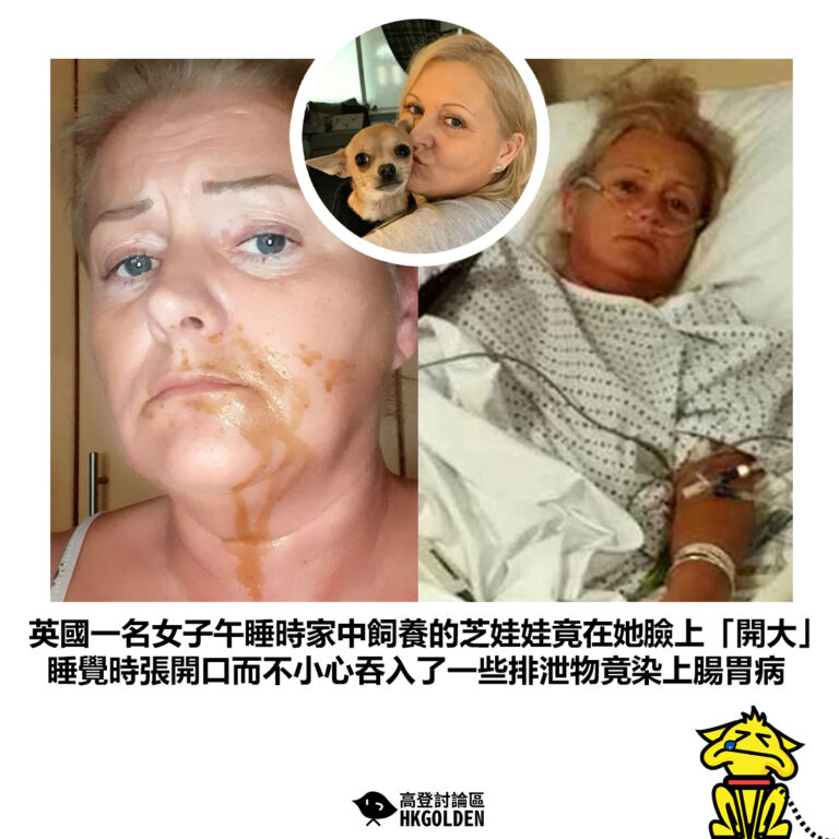 【英國一名女子午睡時家中飼養的芝娃娃竟在她臉上「開大」 睡覺時張開口而不小心吞入了一些排泄物竟染上腸胃病】