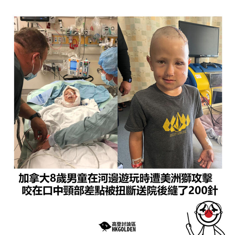 【加拿大8歲男童在河邊遊玩時遭美洲獅攻擊 咬在口中頸部差點被扭斷送院後縫了200針】