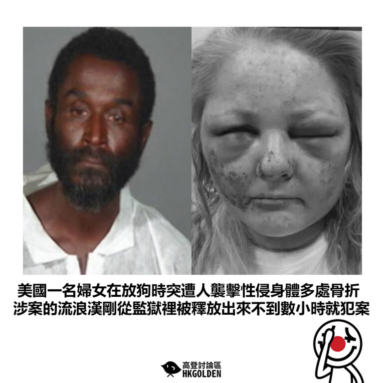 【美國一名婦女在放狗時突遭人襲擊性侵身體多處骨折 涉案的流浪漢剛從監獄裡被釋放出來不到數小時就犯案】
