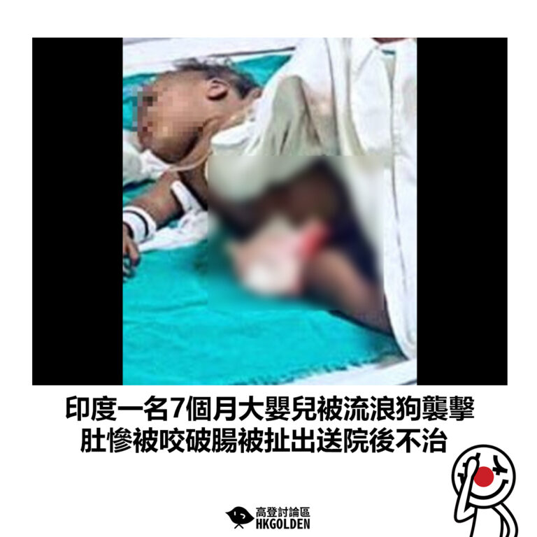【印度一名7個月大嬰兒被流浪狗襲擊 肚慘被咬破腸被扯出送院後不治】