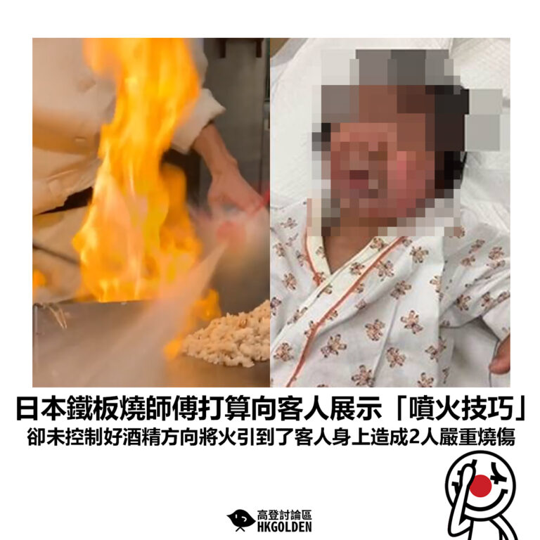 【日本鐵板燒師傅打算向客人展示「噴火技巧」卻未控制好酒精方向將火引到了客人身上造成2人嚴重燒傷】