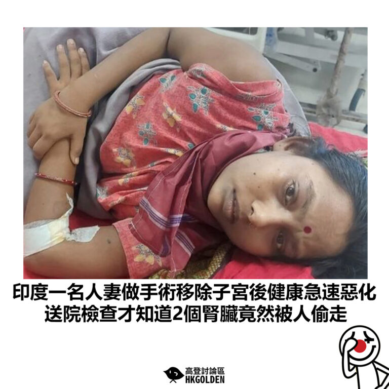 【印度一名人妻做手術移除子宮後健康急速惡化 送院檢查才知道2個腎臟竟然被人偷走】