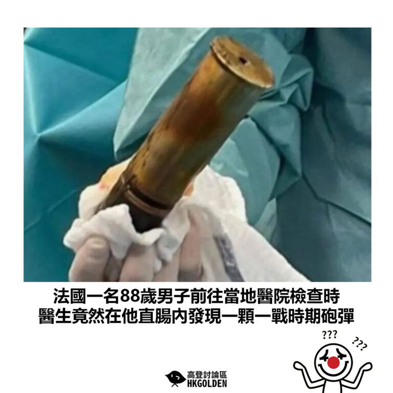 【法國一名88歲男子前往當地醫院檢查時 醫生竟然在他直腸內發現一顆一戰時期砲彈】