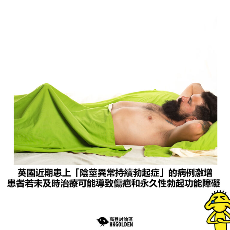 【英國近期患上「陰莖異常持續勃起症」的病例激增 患者若未及時治療可能導致傷疤和永久性勃起功能障礙】