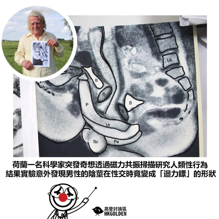 【荷蘭一名科學家突發奇想透過磁力共振掃描研究人類性行為 結果實驗意外發現男性的陰莖在性交時竟變成「迴力鏢」的形狀】