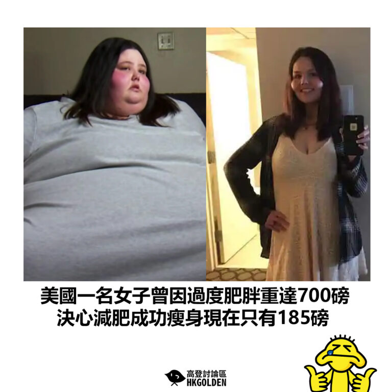 【美國一名女子曾因過度肥胖重達700磅 決心減肥成功瘦身現在只有185磅】