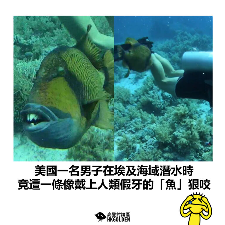【美國一名男子在埃及海域潛水時  竟遭一條像戴上人類假牙的「魚」狠咬】