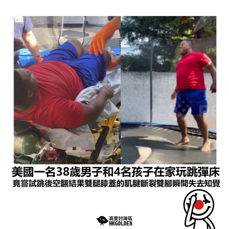 【美國一名38歲男子和4名孩子在家玩跳彈床 竟嘗試跳後空翻結果雙腿膝蓋的肌腱斷裂雙腳瞬間失去知覺 】