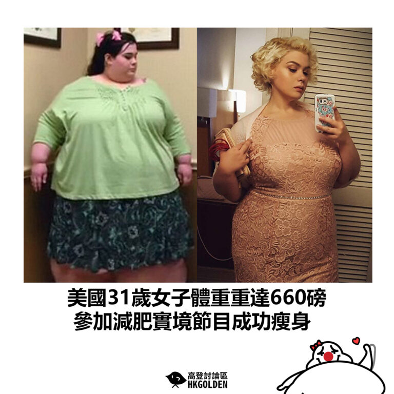 【美國31歲女子體重重達660磅 參加減肥實境節目成功瘦身】
