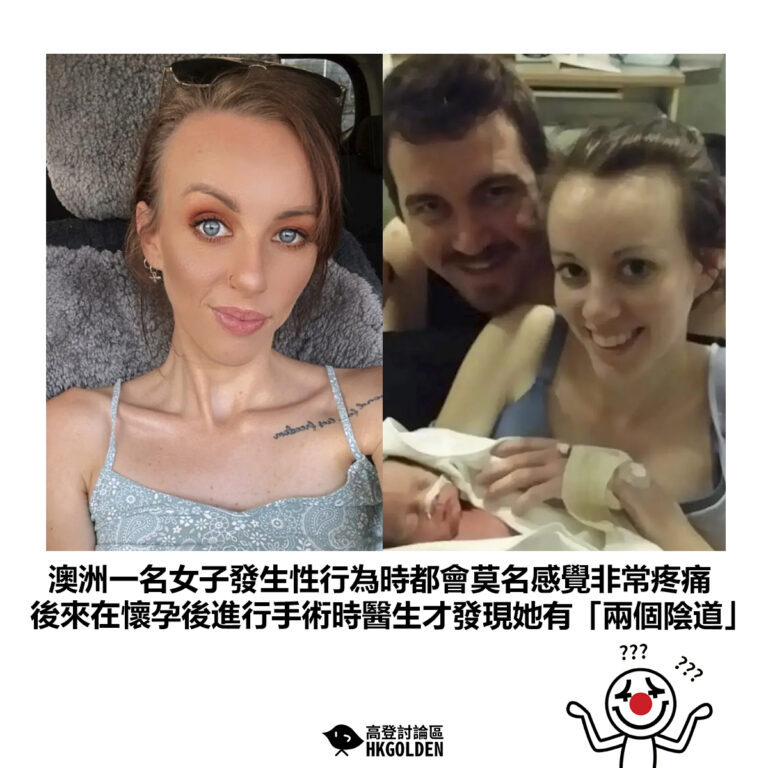【澳洲一名女子發生性行為時都會莫名感覺非常疼痛 後來在懷孕後進行手術時醫生才發現她有「兩個陰道」】