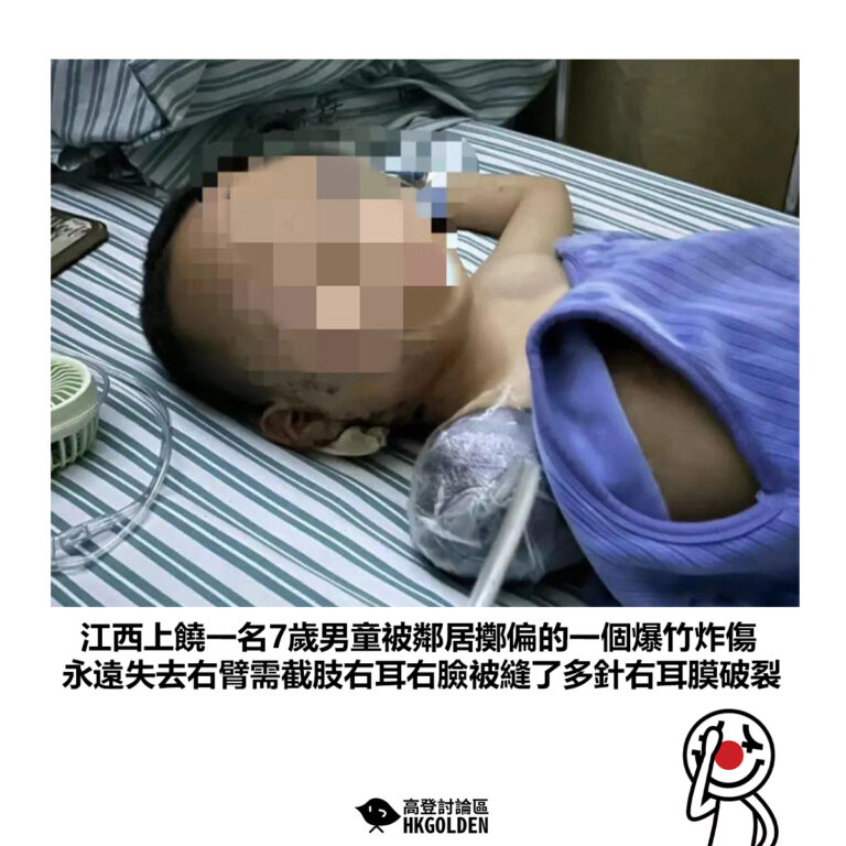 【江西上饒一名7歲男童被鄰居擲偏的一個爆竹炸傷 永遠失去右臂需截肢右耳右臉被縫了多針右耳膜破裂】