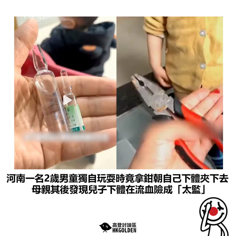 【河南一名2歲男童獨自玩耍時竟拿鉗朝自己下體夾下去 母親其後及現兒子下體在流血險成「太監」】