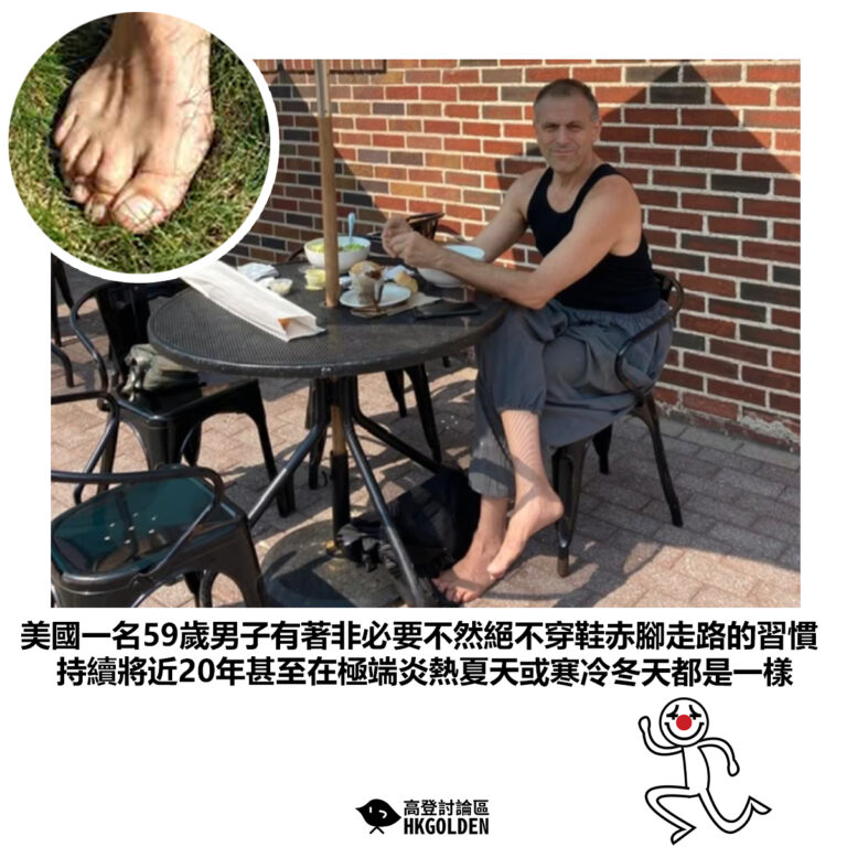 【美國一名59歲男子有著非必要不然絕不穿鞋赤腳走路的習慣 持續將近20年甚至在極端炎熱夏天或寒冷冬天都是一樣】