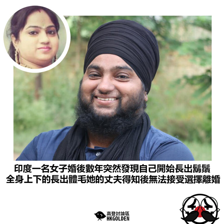 【印度一名女子婚後數年突然發現自己開始長出鬍鬚 全身上下的長出體毛她的丈夫得知後無法接受選擇離婚】