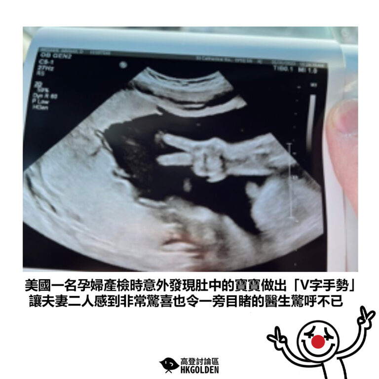 【美國一名孕婦產檢時意外發現肚中的寶寶做出「V字手勢」 讓夫妻二人感到非常驚喜也令一旁目睹的醫生驚呼不已】