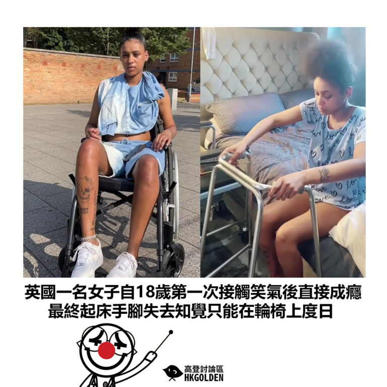 【英國一名女子自18歲第一次接觸笑氣後直接成癮 最終起床手腳失去知覺只能在輪椅上度日】