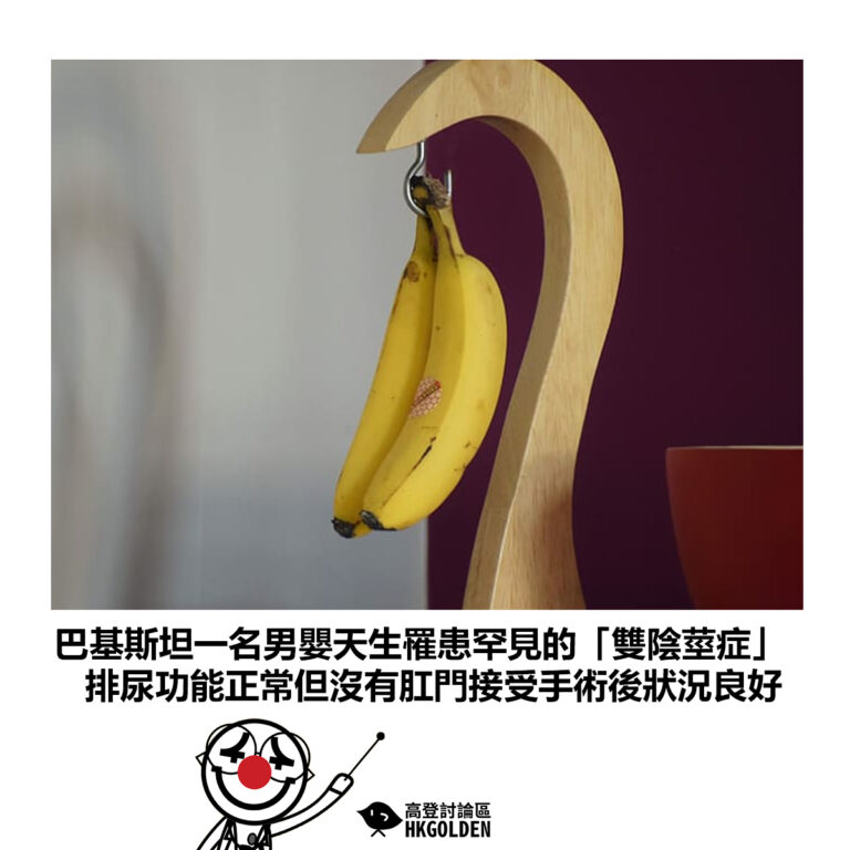 【巴基斯坦一名男嬰天生罹患罕見的「雙陰莖症」排尿功能正常但沒有肛門接受手術後狀況良好】