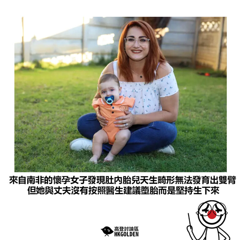 【來自南非的懷孕女子發現肚內胎兒天生畸形無法發育出雙臂 但她與丈夫沒有按照醫生建議墮胎而是堅持生下來】