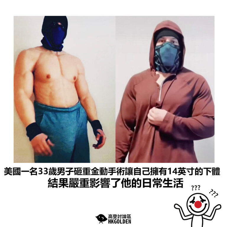【美國一名33歲男子砸重金動手術讓自己擁有14英寸的下體 但「巨根」嚴重影響了他的日常生活】