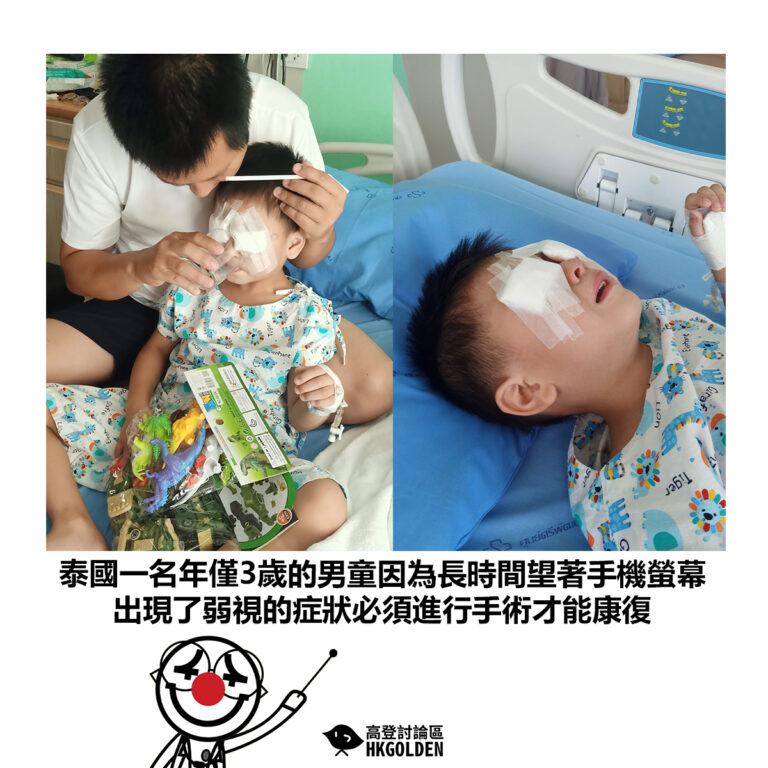 【泰國一名年僅3歲的男童因為長時間望著手機螢幕 出現了弱視的症狀必須進行手術才能康復】