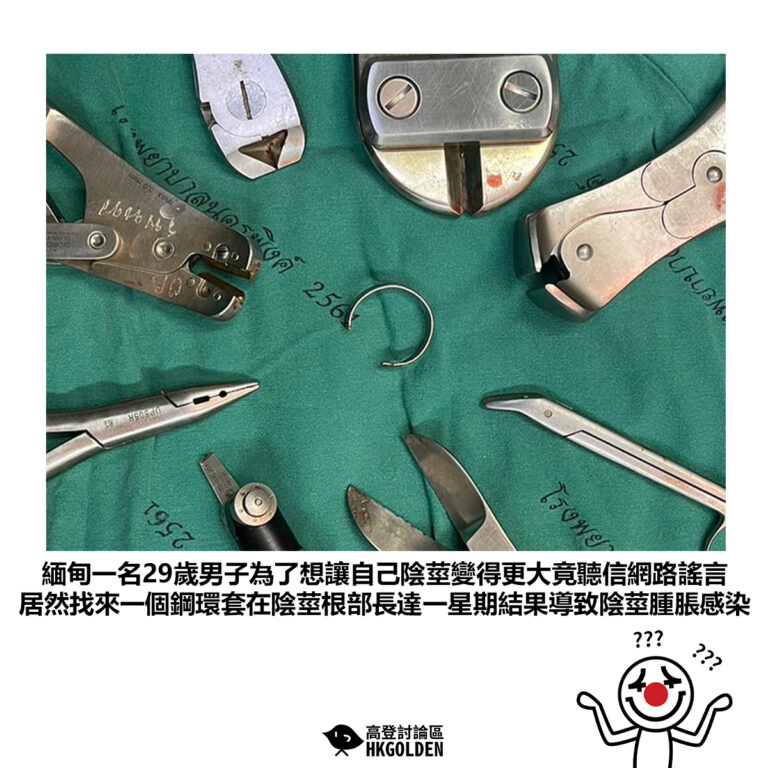 【緬甸一名29歲男子為了想讓自己陰莖變得更大竟聽信網路謠言 居然找來一個鋼環套在陰莖根部長達一星期結果導致陰莖腫脹感染 】