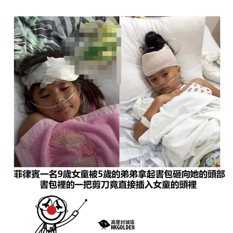 【菲律賓一名9歲女童被5歲的弟弟拿起書包砸向她的頭部 書包裡的一把剪刀竟直接插入女童的頭裡】