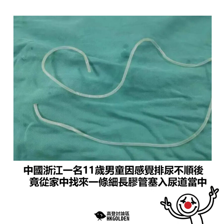 【中國浙江一名11歲男童因感覺排尿不順後 竟從家中找來一條細長膠管塞入尿道當中】