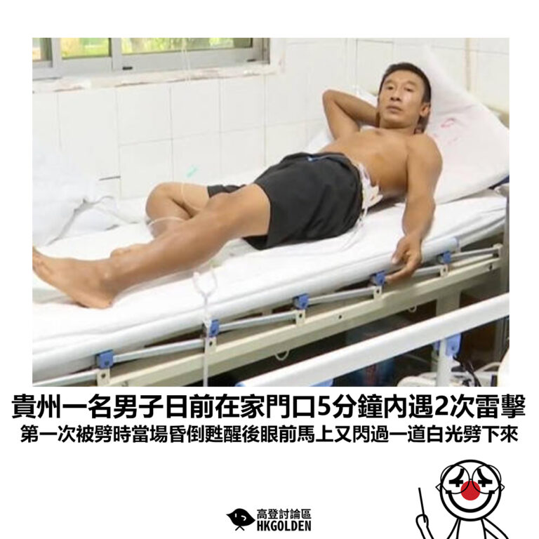 【貴州一名男子日前在家門口5分鐘內遇2次雷擊 第一次被劈時當場昏倒甦醒後眼前馬上又閃過一道白光劈下來 】