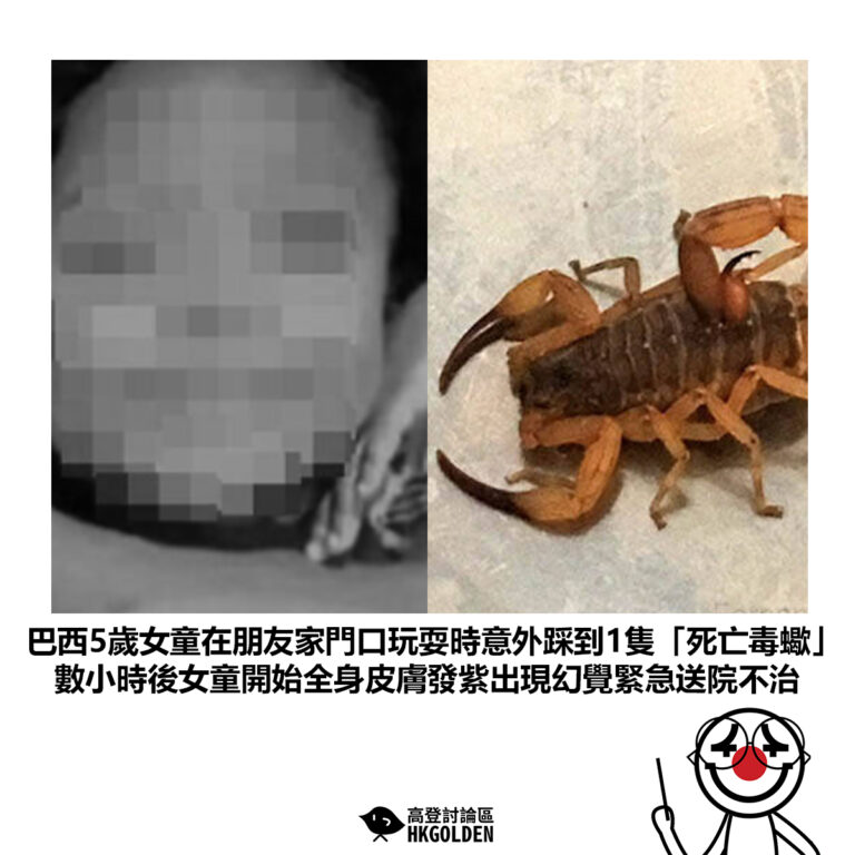 【巴西5歲女童在朋友家門口 玩耍時意外踩到1隻「死亡毒蠍」數小時後女童開始全身皮膚發紫出現幻覺緊急送院不治】