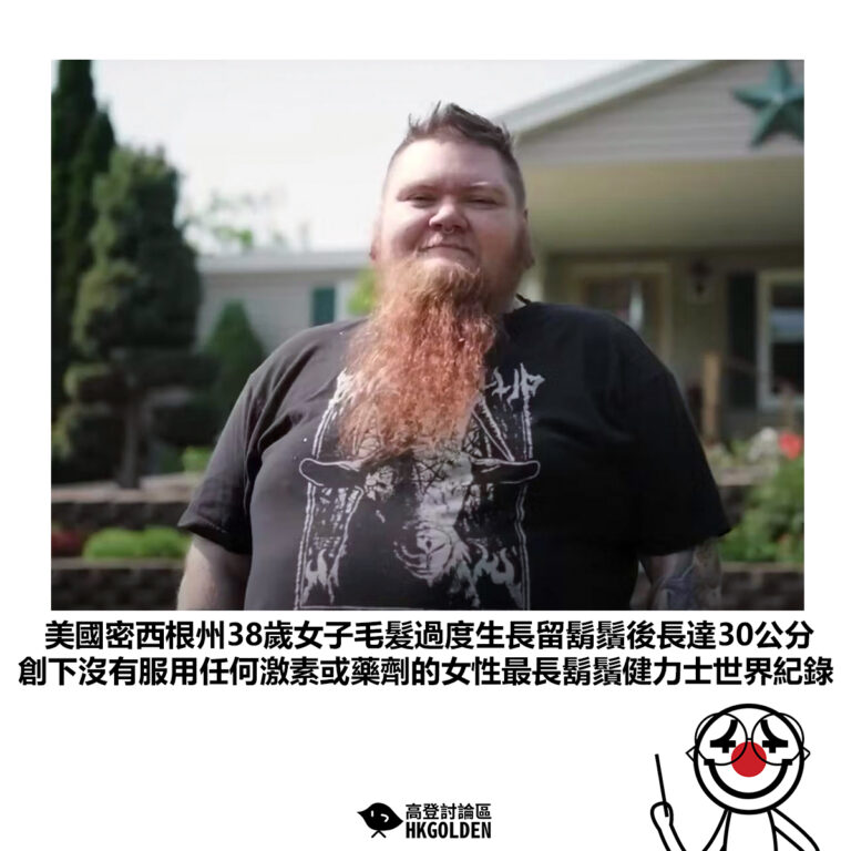 【美國密西根州38歲女子毛髮過度生長留鬍鬚後長達30公分 創下沒有服用任何激素或藥劑的女性最長鬍鬚健力士世界紀錄】