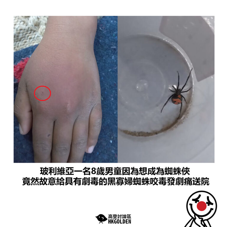 【玻利維亞一名8歲男童因為想成為蜘蛛俠 竟然故意給具有劇毒的黑寡婦蜘蛛咬毒發劇痛送院】