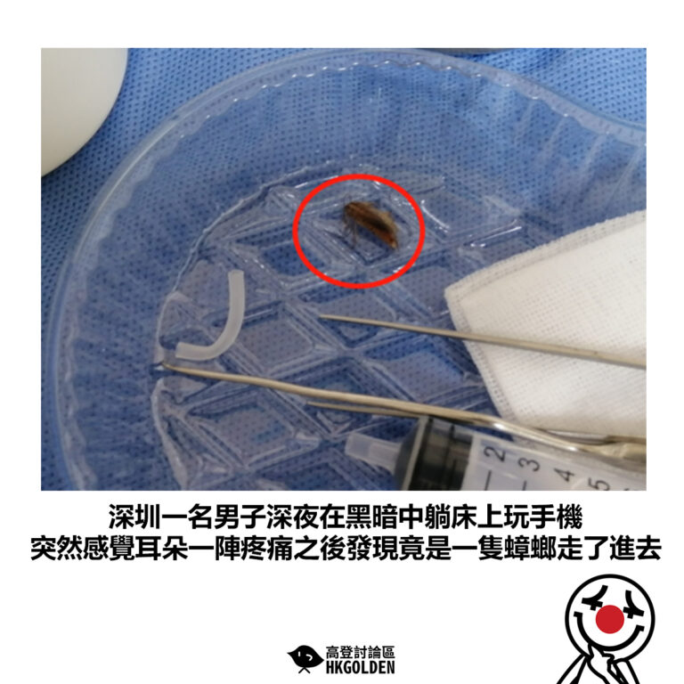【深圳一名男子深夜在黑暗中躺床上玩手機 突然感覺耳朵一陣疼痛之後發現竟是一隻蟑螂走了進去】