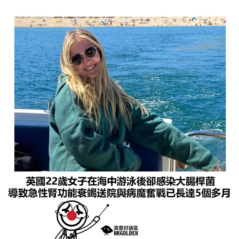 【英國22歲女子在海中游泳後卻感染大腸桿菌 導致急性腎功能衰竭送院與病魔奮戰已長達5個多月】