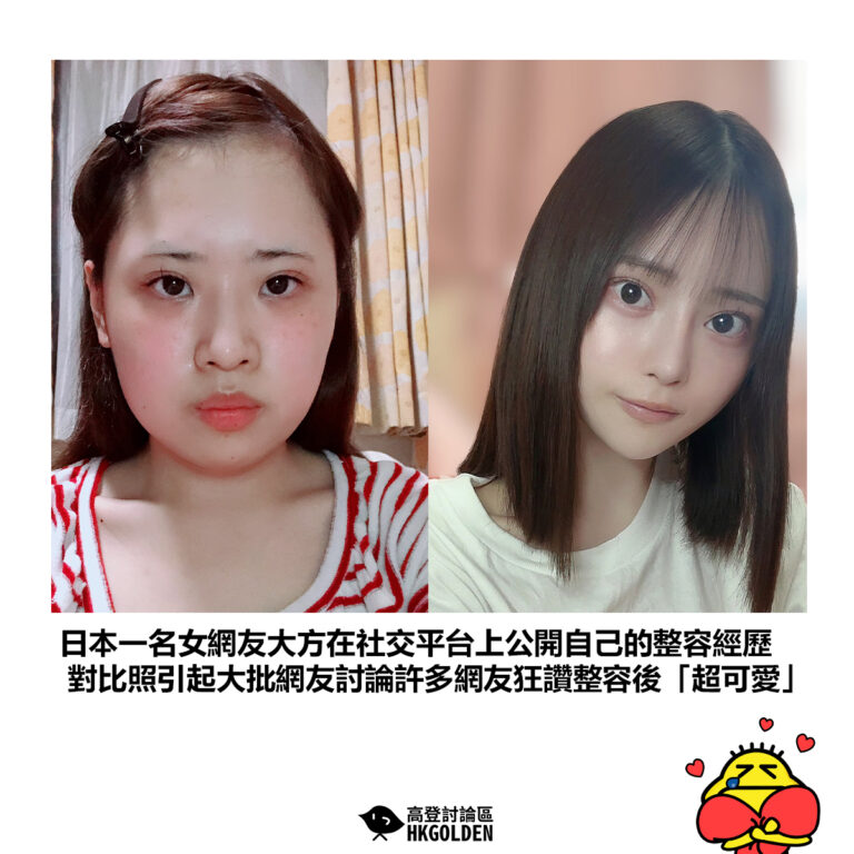 【日本一名女網友大方在社交平台上公開自己的整容經歷 對比照引起大批網友討論許多網友狂讚整容後「超可愛」】