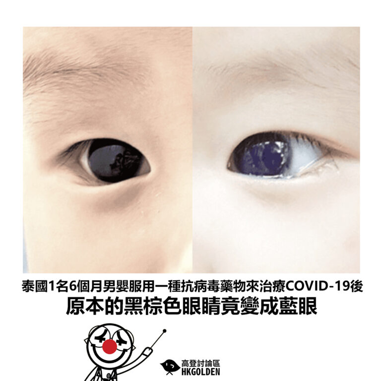 【泰國1名6個月男嬰服用一種抗病毒藥物來治療COVID-19後 原本的黑棕色眼睛竟變成藍眼】