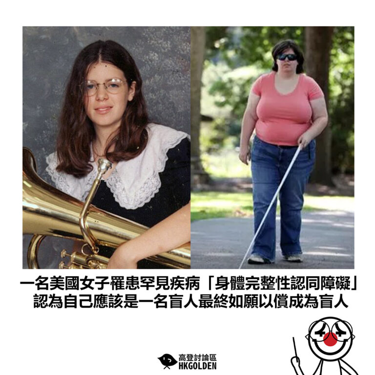 【一名美國女子罹患罕見疾病「身體完整性認同障礙」認為自己應該是一名盲人最終如願以償成為盲人】