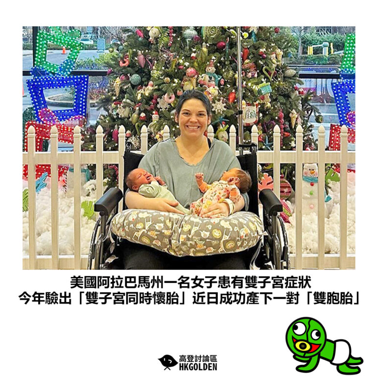 【美國阿拉巴馬州一名女子患有雙子宮症狀 今年驗出「雙子宮同時懷胎」近日成功產下一對「雙胞胎」】