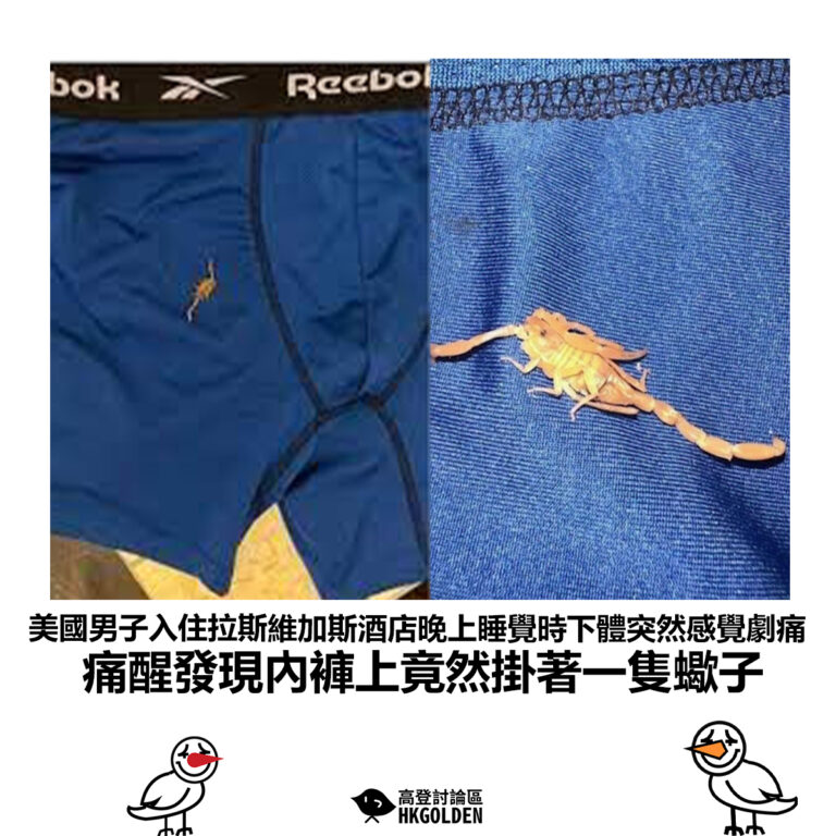 【美國男子入住拉斯維加斯酒店晚上睡覺時下體突然感覺劇痛 痛醒發現內褲上竟然掛著一隻蠍子】