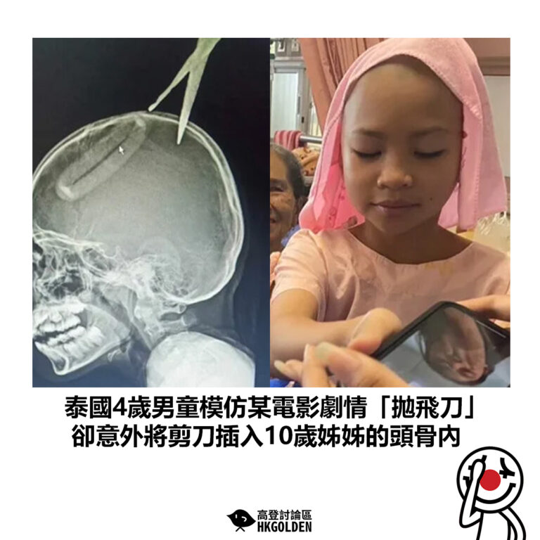 【泰國4歲男童模仿某電影劇情「拋飛刀」 卻意外將剪刀插入10歲姊姊的頭骨內】