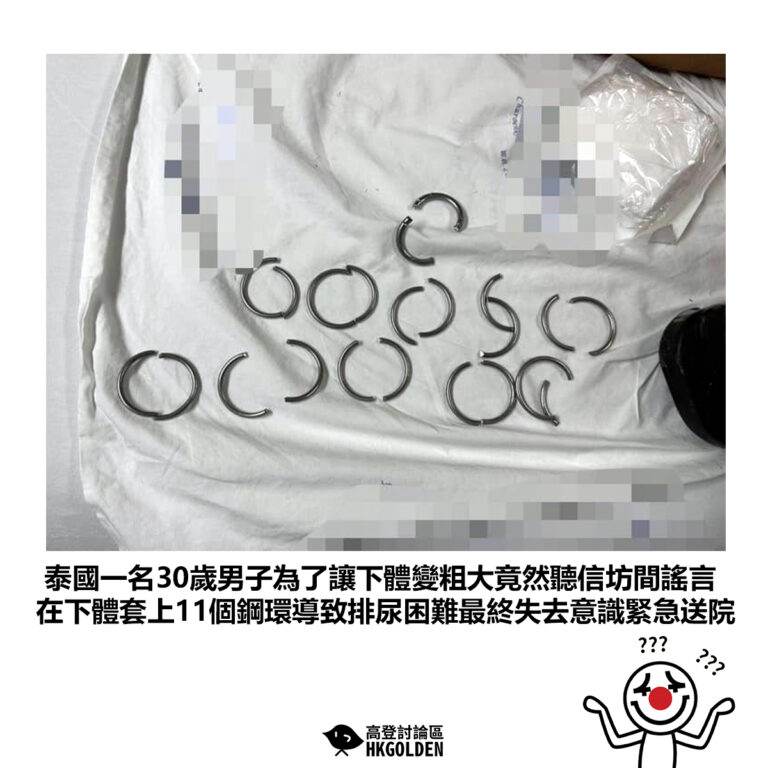 【泰國一名30歲男子為了讓下體變粗大竟然聽信坊間謠言 在下體套上11個鋼環導致排尿困難最終失去意識緊急送院 】