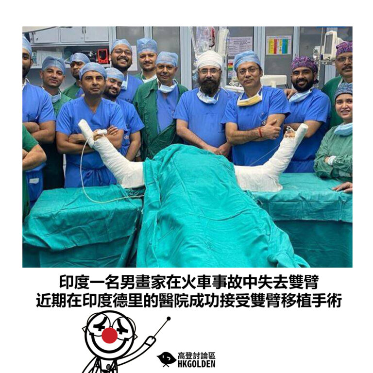 【印度一名男畫家在火車事故中失去雙臂 近期在印度德里的醫院成功接受雙臂移植手術】