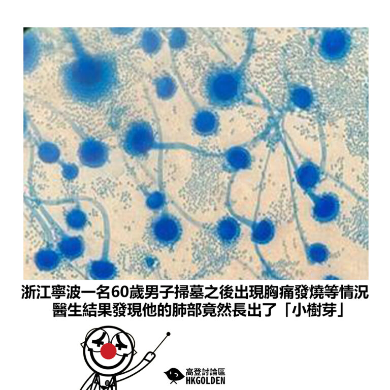 【浙江寧波一名60歲男子掃墓之後出現胸痛發燒等情況 醫生結果發現他的肺部竟然長出了「小樹芽」】