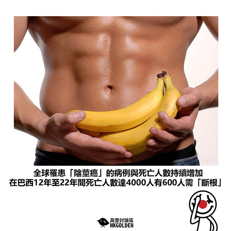 【全球罹患「陰莖癌」的病例與死亡人數持續增加 在巴西12年至22年間死亡人數達4000人有600人需「斷根」】