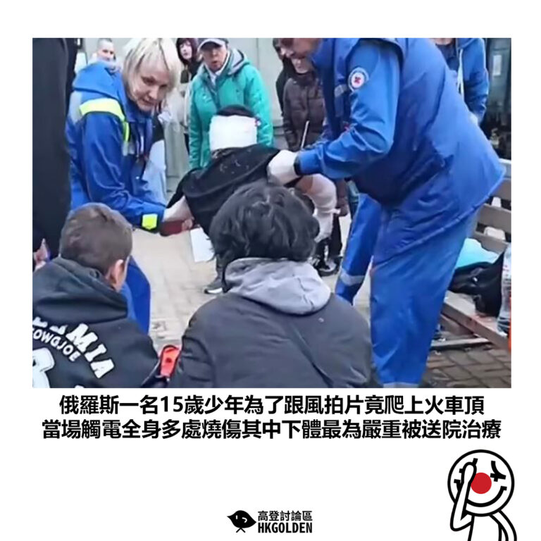 【俄羅斯一名15歲少年為了跟風拍片竟爬上火車頂 當場觸電全身多處燒傷其中下體最為嚴重被送院治療】