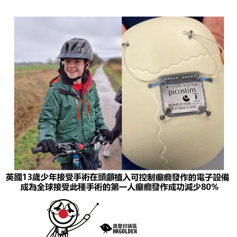 【英國13歲少年接受手術在頭顱植入可控制癲癇發作的電子設備成為全球接受此種手術的第一人癲癇發作成功減少80%  】