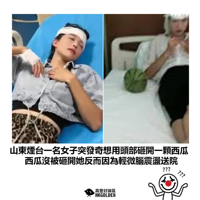 【山東煙台一名女子便突發奇想用頭部砸開一顆西瓜 西瓜沒被砸開她反而因為輕微腦震盪送院】