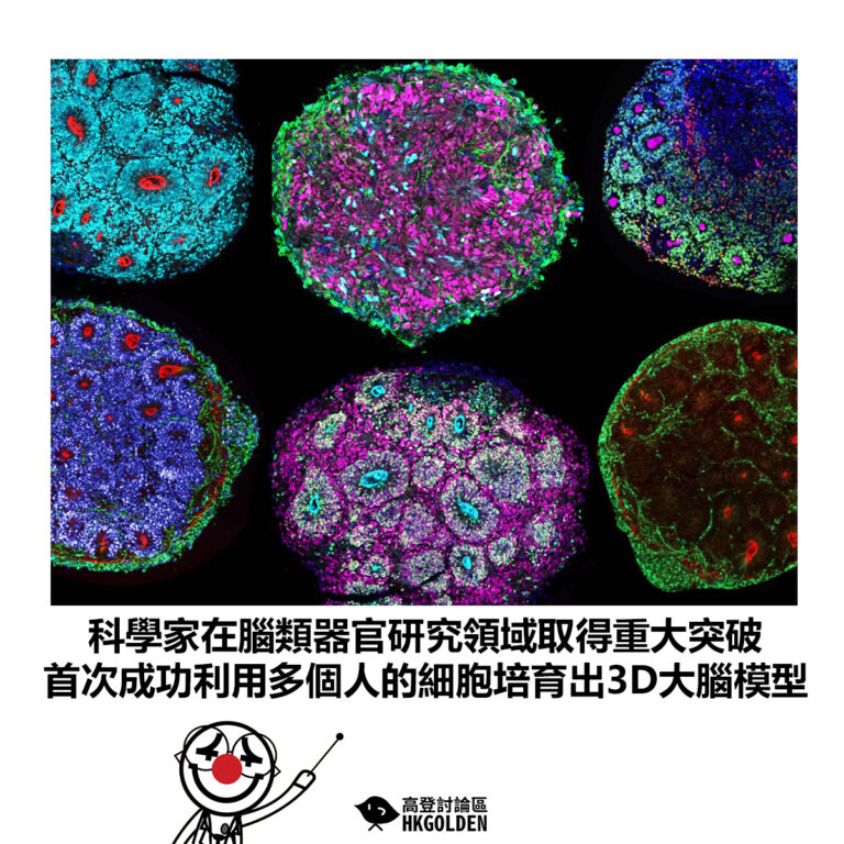 【科學家在腦類器官研究領域取得重大突破 首次成功利用多個人的細胞培育出3D大腦模型】